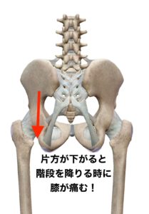 骨盤が下がる