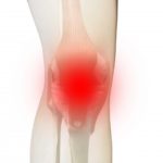 膝を揉んでも良くならない理由｜女性に多い“膝痛”の本当の原因とは？